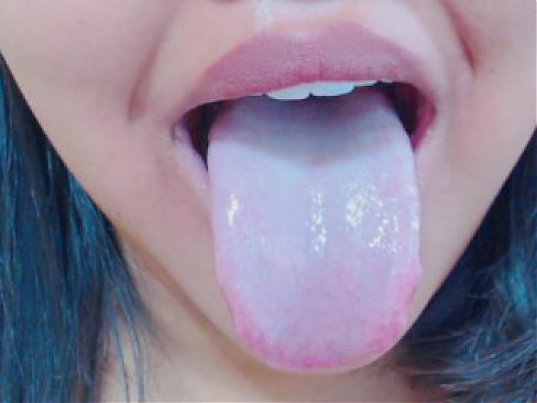 舌头，扁桃体和喉咙检查